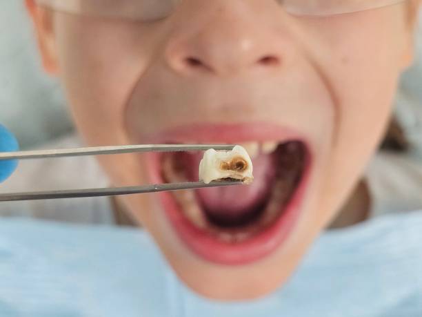 Mobile Emergency Dentist