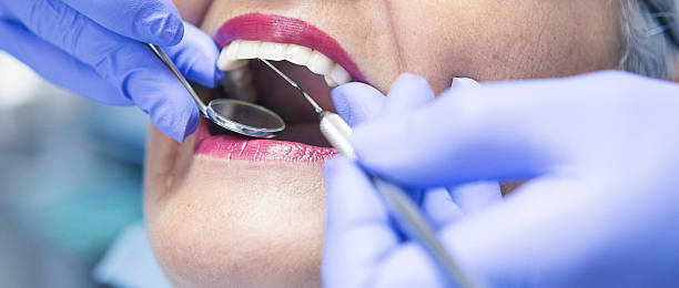 Best Emergency Dental Care for Abscessed Tooth in Buellton, CA